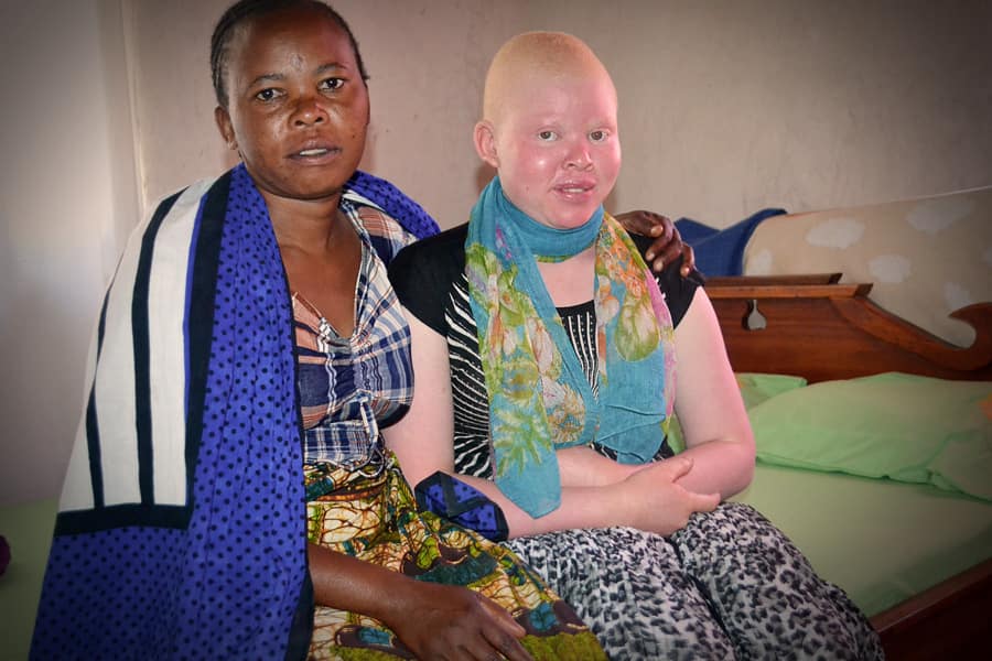 Embracing Diversity: Celebrating International Albinism Awareness Day 2025